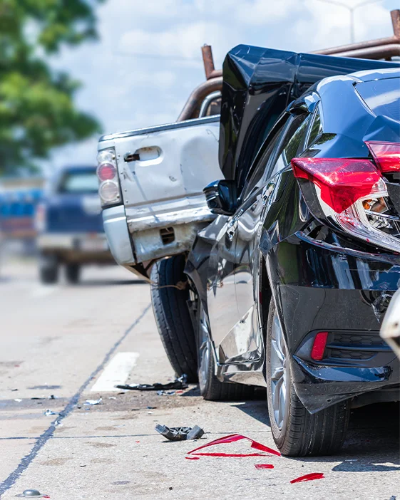 injury-left-img