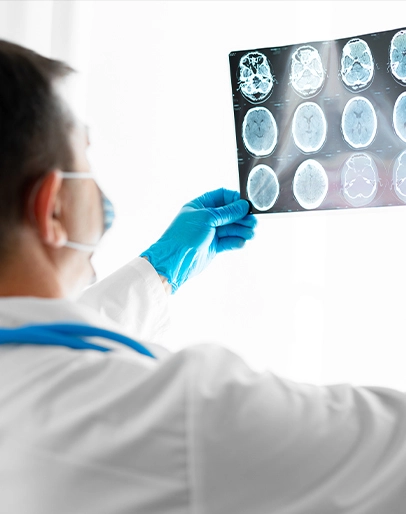 Traumatic Brain Injuries Image